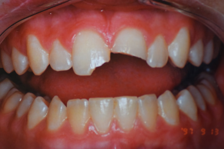 Before dental treatment