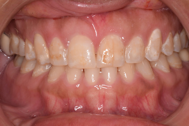 Before dental treatment