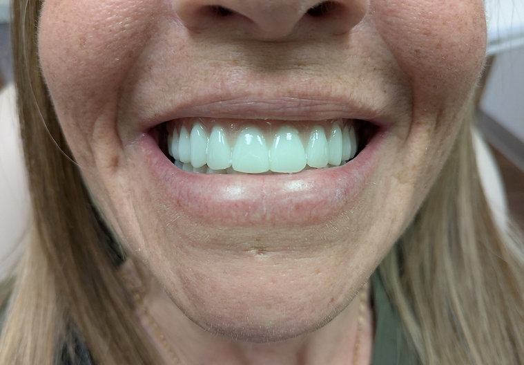 After dental treatment - improved smile