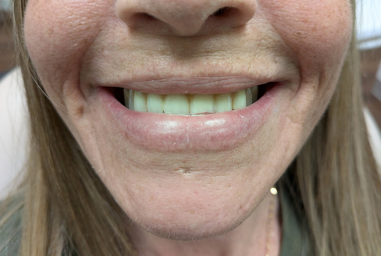 Before dental treatment