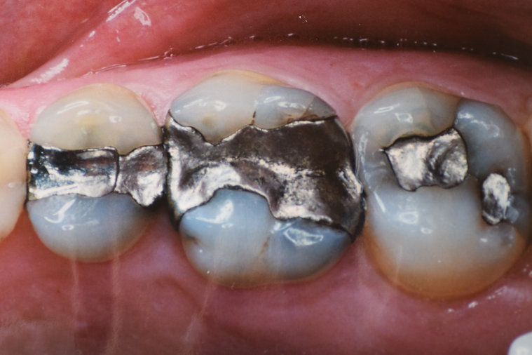 Before dental treatment